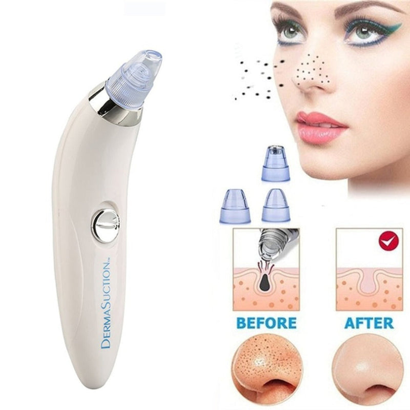 4 IN 1 DERMA VACUUM SUCTION BLACKHEAD/ACNE/OIL/PORE CLEANER