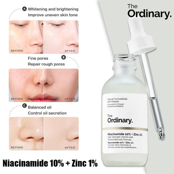 Buy 1 ( The Ordinary Niacinamde 10% +Zinc 1% ) & Get 2 Free ( Jade Roller and Gua Sha Stone )